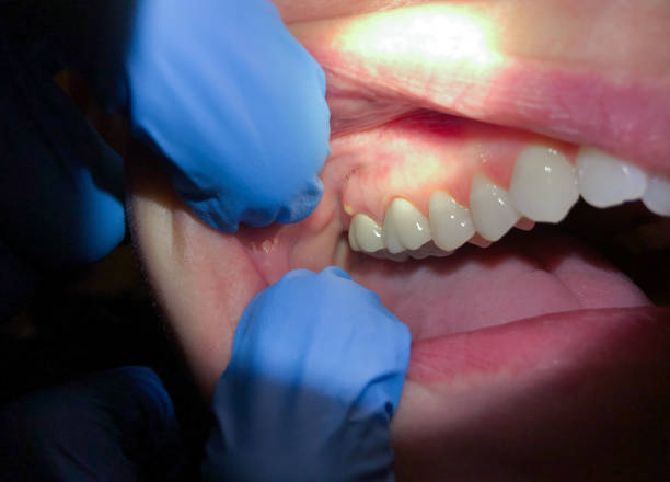Best Emergency Cosmetic Dentistry in Skippers Corner, NC