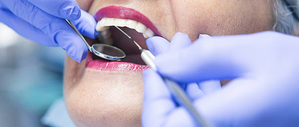 Best Emergency Root Canal Treatment in Skippers Corner, NC